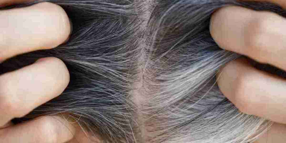 Does Stress Really Make Your Hair Turn Gray?