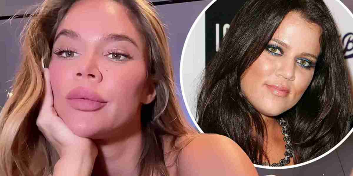 'Do you miss your old face?' Khloe Kardashian gives VERY honest response after fan calls out her dramatically 