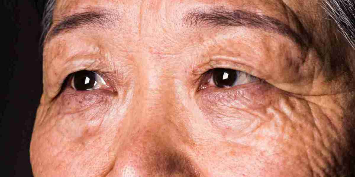 Your Vision Can Predict Dementia 12 Years Before Diagnosis, Study Finds