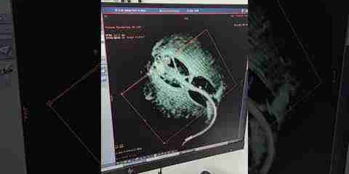 Electrocardiograma en Salud Digna: Cita Precios Resultados